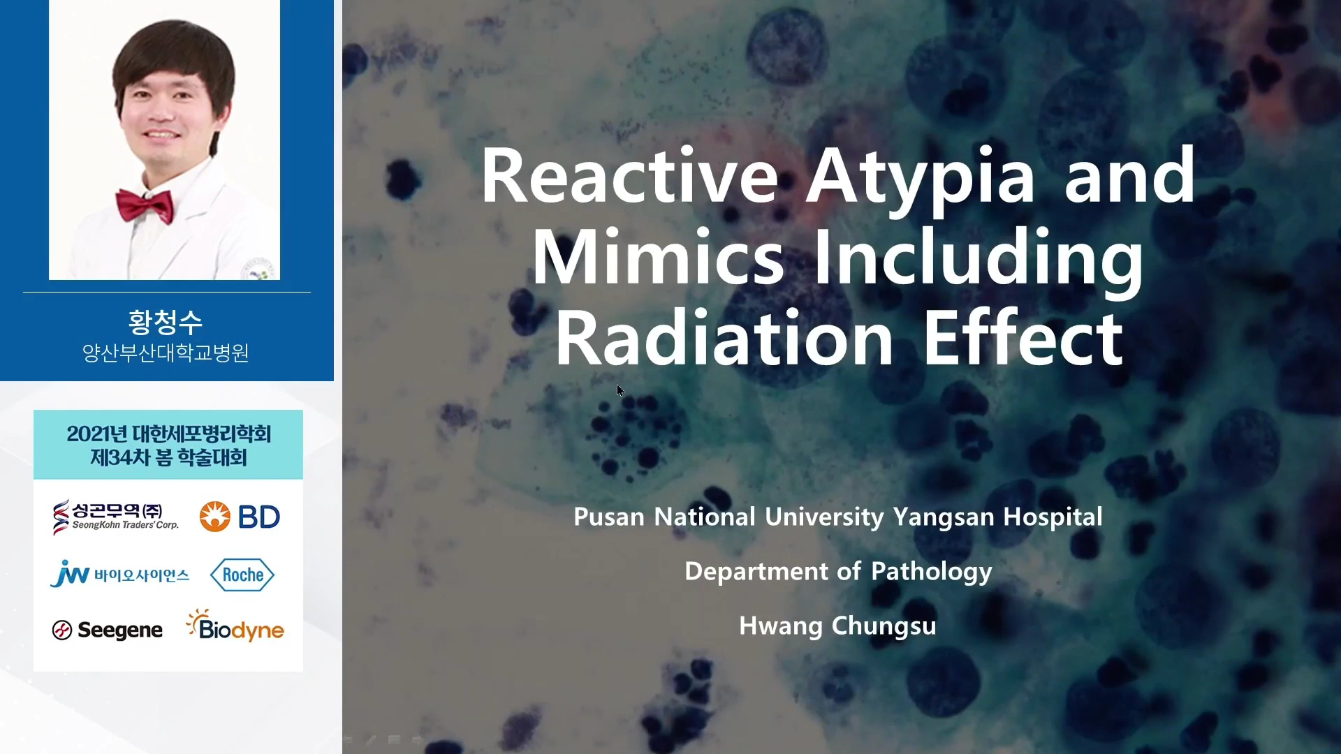Reactive atypia and mimics including post-radiation changes