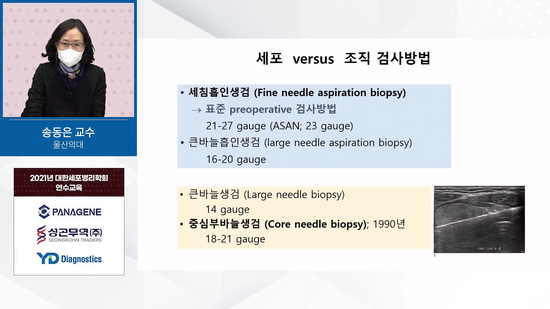 Thyroid FNA: basic approach for newly starting cytopathologists