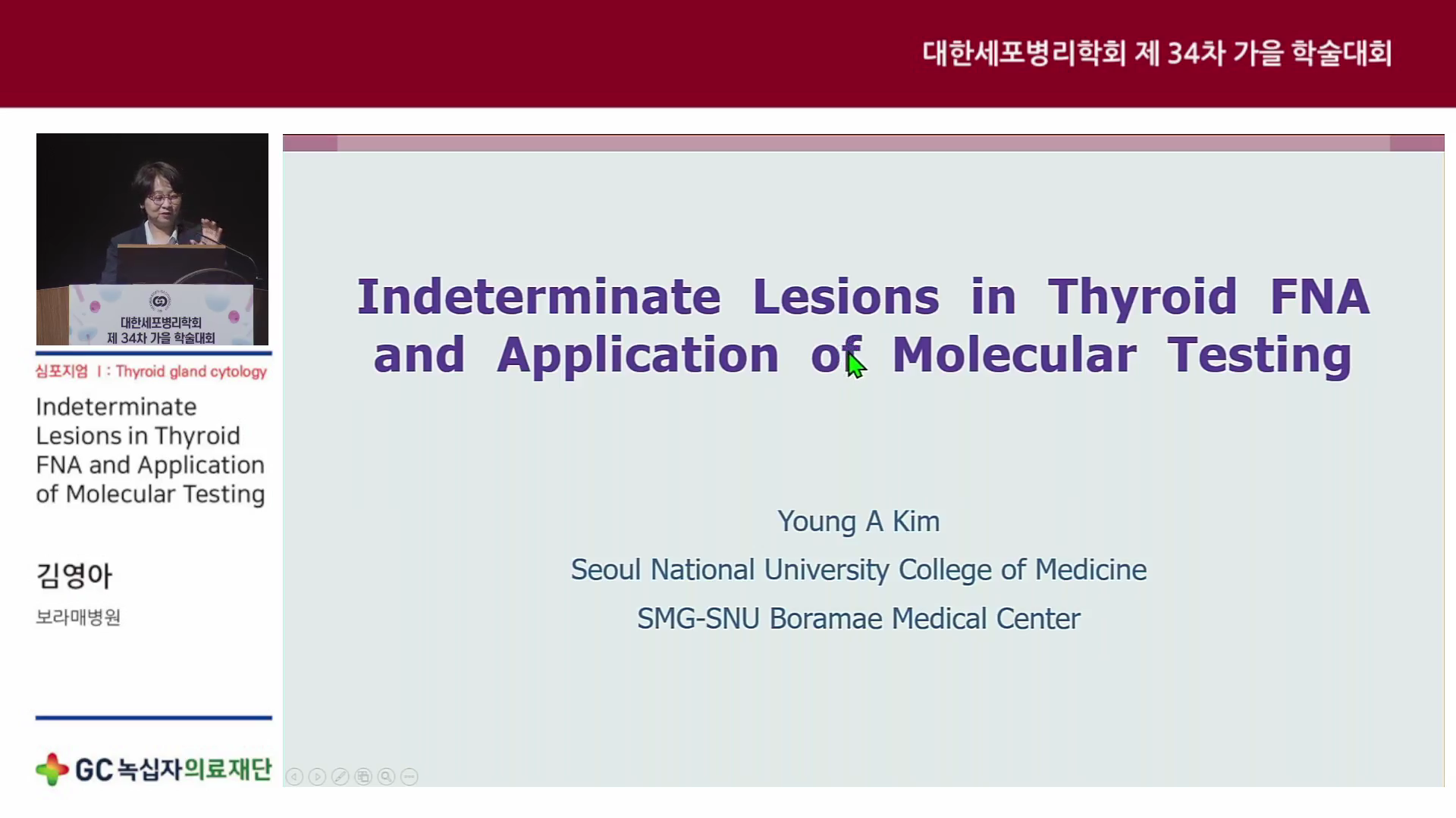 Indeterminate Lesions in Thyroid FNA and Application of Molecular Testing