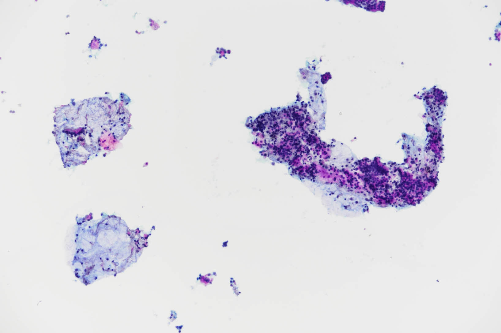 +cartilageandepithelialcells-x100-1_202503981637365.jpg