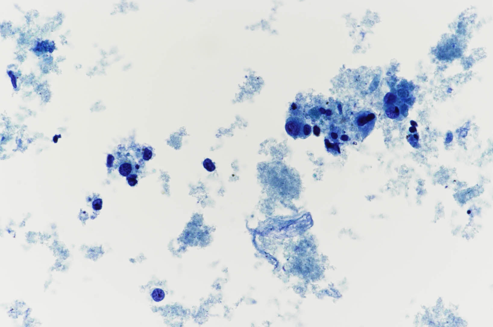 +necroticcells-x400-1_20250398400545.jpg