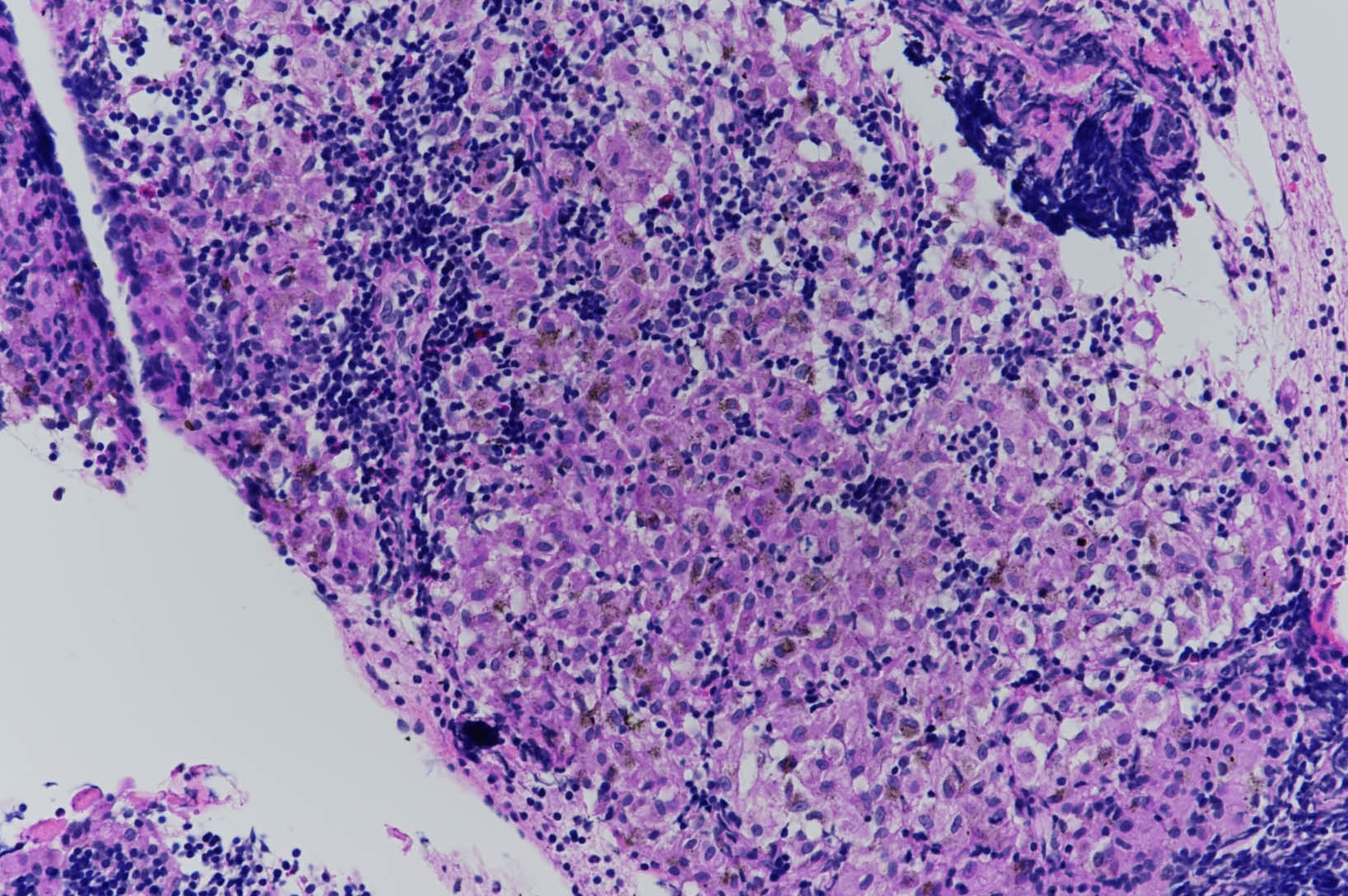 H24-18511_X200-dustladenhistiocytes_20250112111836458.jpg