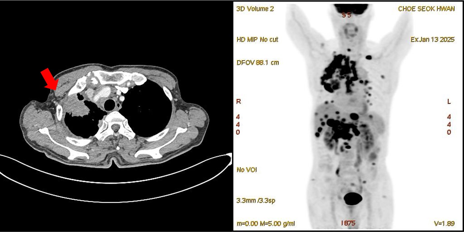 H25-755CT_PETCT-1_202502991428281.jpg
