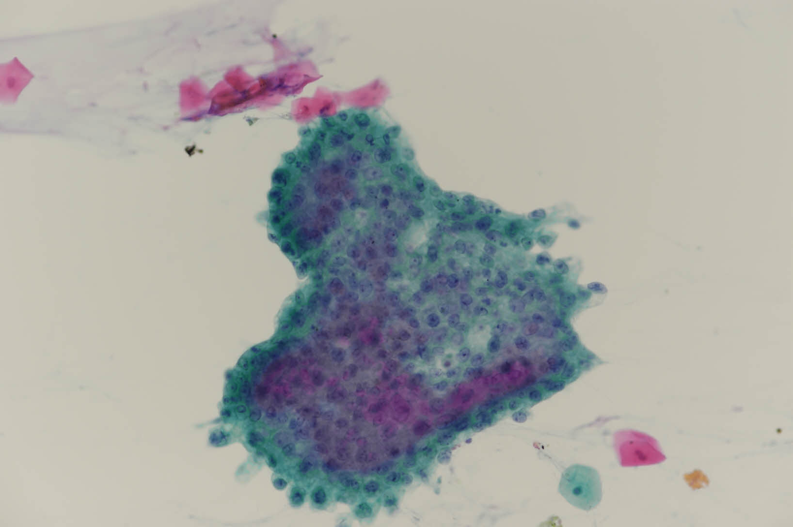 NG25-997sputum-x200-1_202503292450598.jpg
